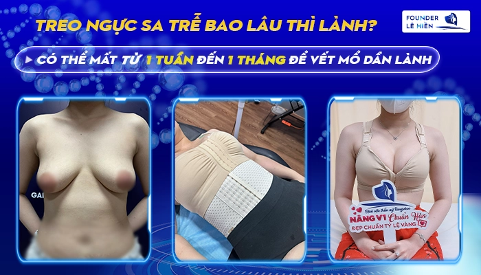 Giải Đáp: Treo Ngực Sa Trễ Bao Lâu Thì Lành?