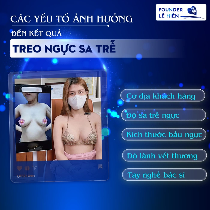 Các Yếu Tố Ảnh Hưởng Đến Kết Quả Duy Trì Treo Ngực Sa Trễ 