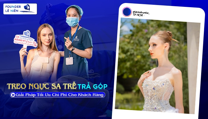 Treo Ngực Sa Trễ Trả Góp - Giải Pháp Tối Ưu Chi Phí Cho Khách Hàng