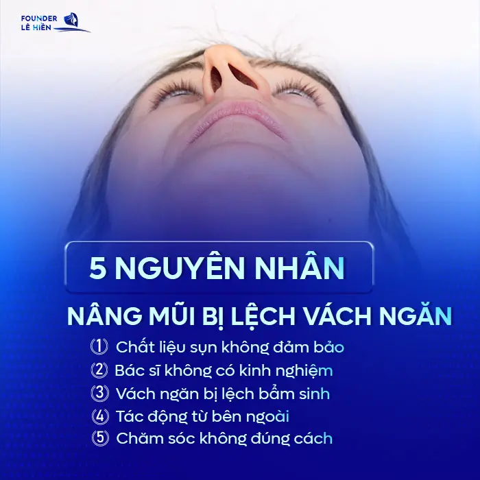 Nâng Mũi Bị Lệch Vách Ngăn