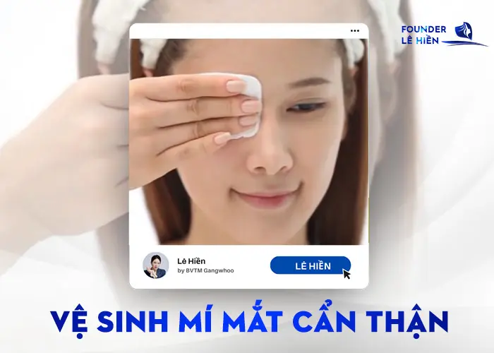 Cắt Mí Mắt Sưng Không Đều