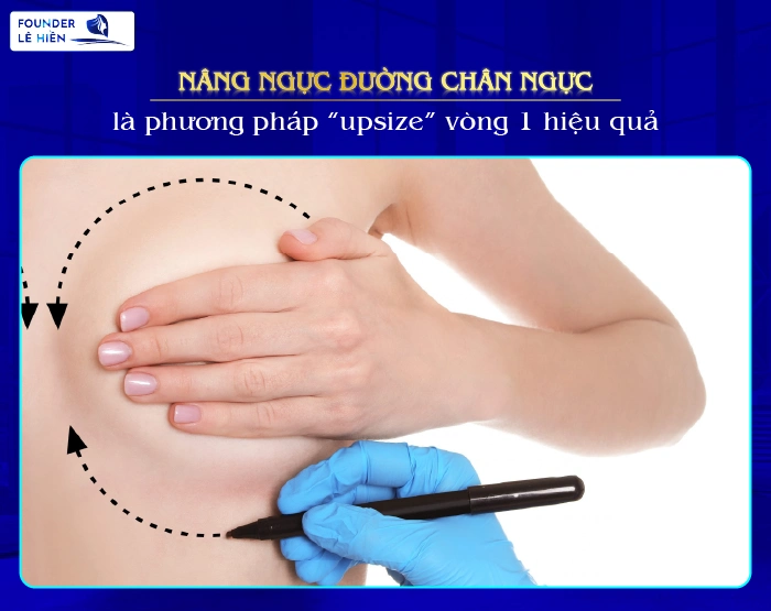 Nâng Ngực Đường Chân Ngực