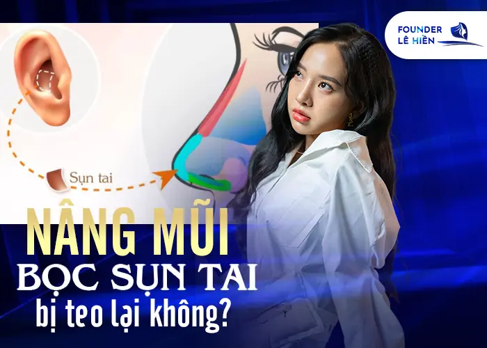 Nâng Mũi Bằng Sụn Tai Có Bị Teo Lại Không