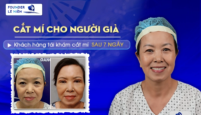 Giải Đáp: Cắt Mí Mắt Cho Người Già Có Được Không?