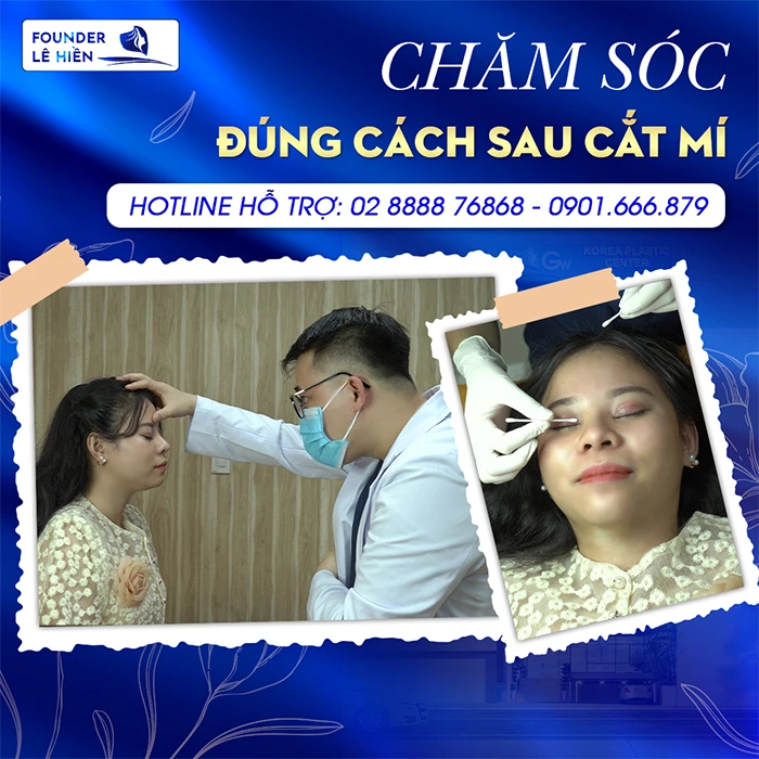 Hướng Dẫn Cách Giảm Sưng Sau Cắt Mí Mắt 