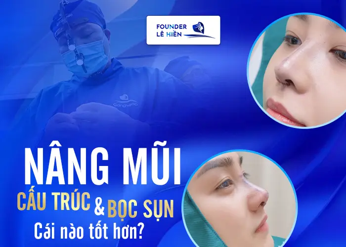 Có Nên Nâng Mũi Bọc Sụn