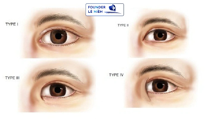 Tạo hình góc mắt trong