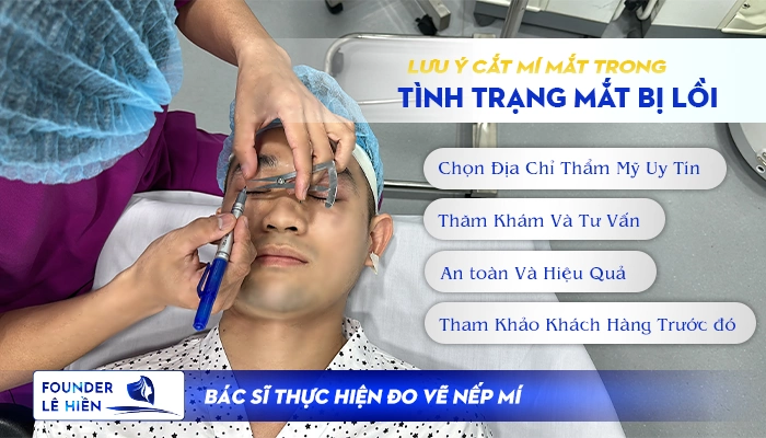 Lưu Ý Quan Trong Khi Thực Hiện Cắt Mí Trong Trường Hợp Mắt Lồi 