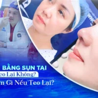 nang-mui-bang-sun-tai-co-bi-teo-lai-khong