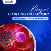 nang-mui-co-bi-ung-thu-khong