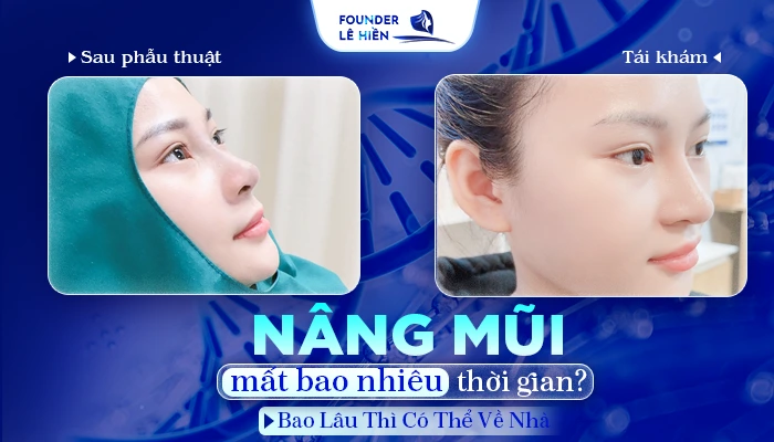 nang mui mat bao nhieu thoi gian 1