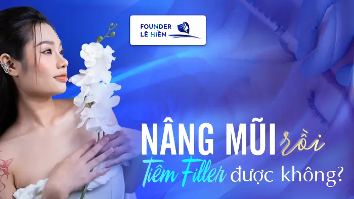 nang mui roi tiem filler duoc khong