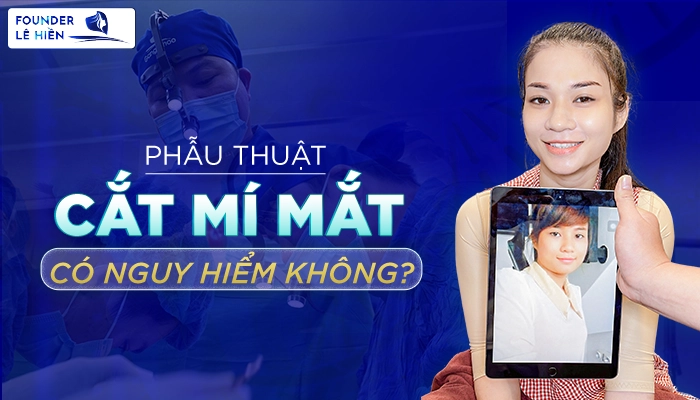 phau thuat cat mi mat co nguy hiem khong