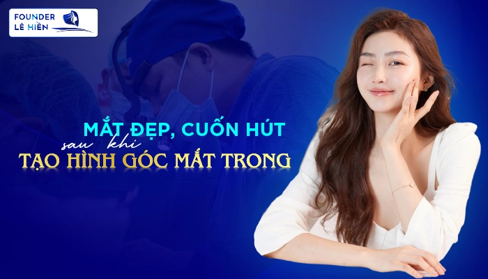 tạo hình góc mắt trong