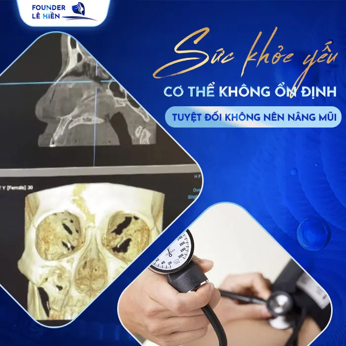 Nâng Mũi Có Bị Ung Thư Không