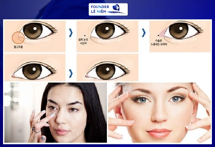 tạo hình góc mắt trong