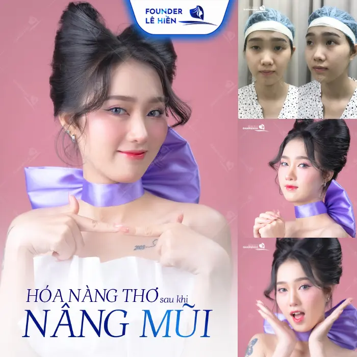 Nâng Mũi Có Thay Đổi Khuôn Mặt Không