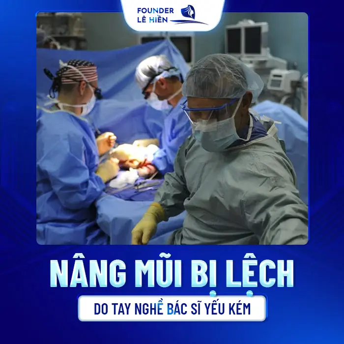 Nâng Mũi Bị Lệch