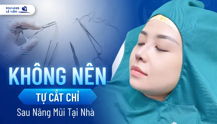 Nâng Mũi Bao Lâu Thì Được Cắt Chỉ