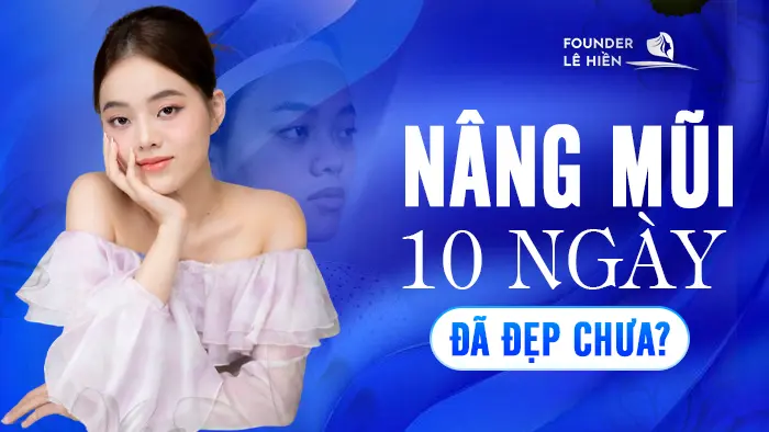 nang mui 10 ngay da dep chua