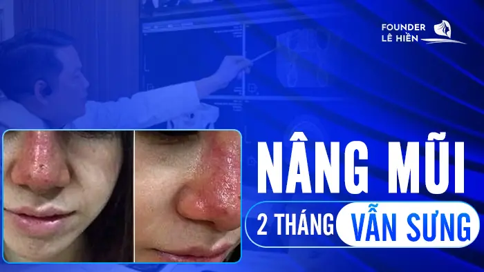 nang mui 2 thang van sung