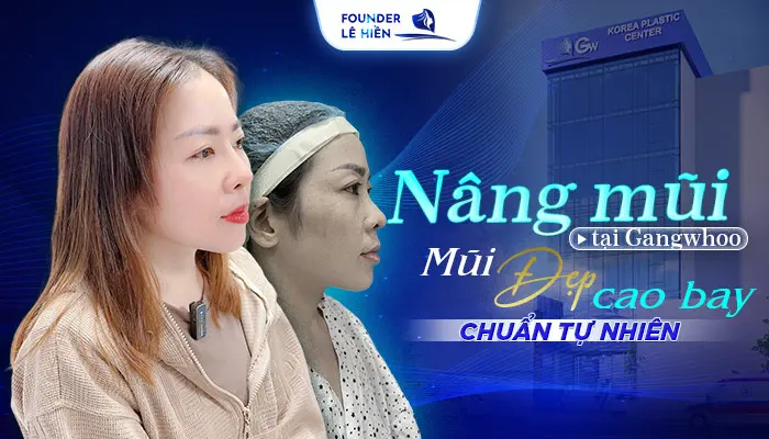 Nâng Mũi Bị Thấp Quá 