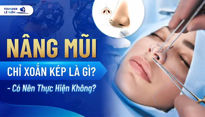 oan kep la gi co nen thuc hien khong