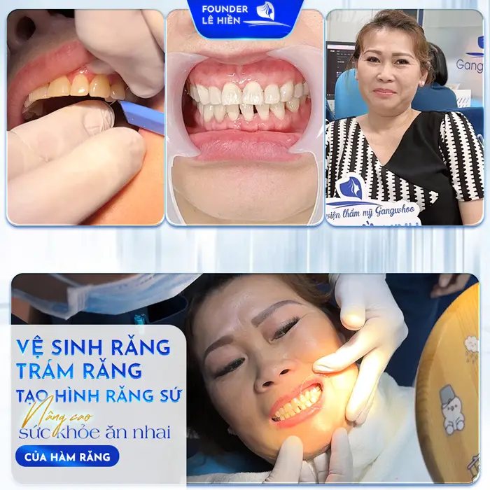 Bệnh viện thẩm mỹ Gangwhoo – Bệnh viện thẩm mỹ chuẩn Hàn