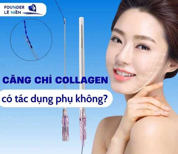 Phương Pháp Căng Chỉ Collagen Có Tác Dụng Phụ Không?