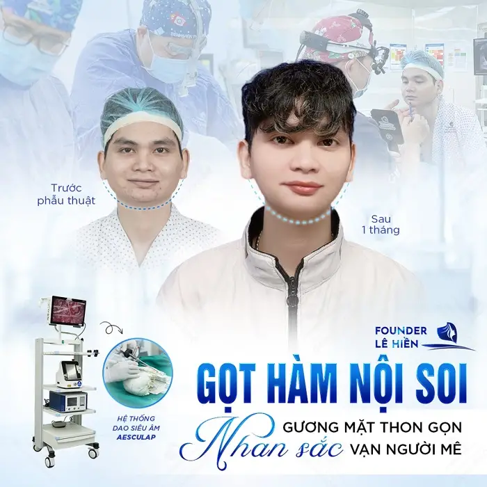 Phẫu Thuật Gọt Hàm Sau Bao Lâu Thì Hết Tê? 5 Bệnh viện thẩm mỹ của Founder Lê Hiền là một trong những địa chỉ gọt hàm uy tín, an toàn