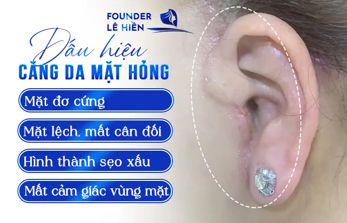 Sửa Căng Da Mặt Hỏng: Nguyên Nhân, Dấu Hiệu & Cách Khắc Phục