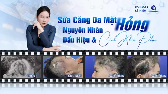 Sửa Căng Da Mặt Hỏng: Nguyên Nhân, Dấu Hiệu & Cách Khắc Phục